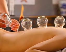 Cupping Therapy